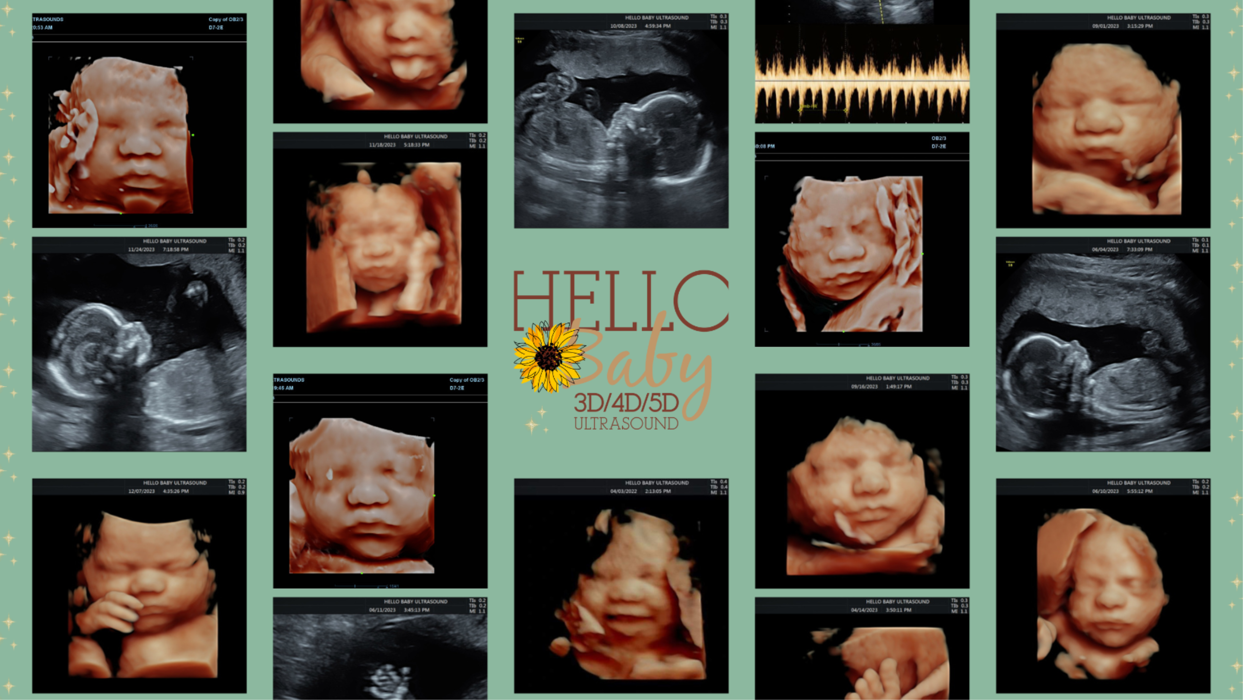 Hello Baby Ultrasounds  Logo